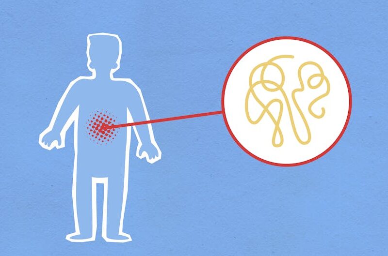 Gut Microbiome and Inflammation: Why Scientists Care So Much